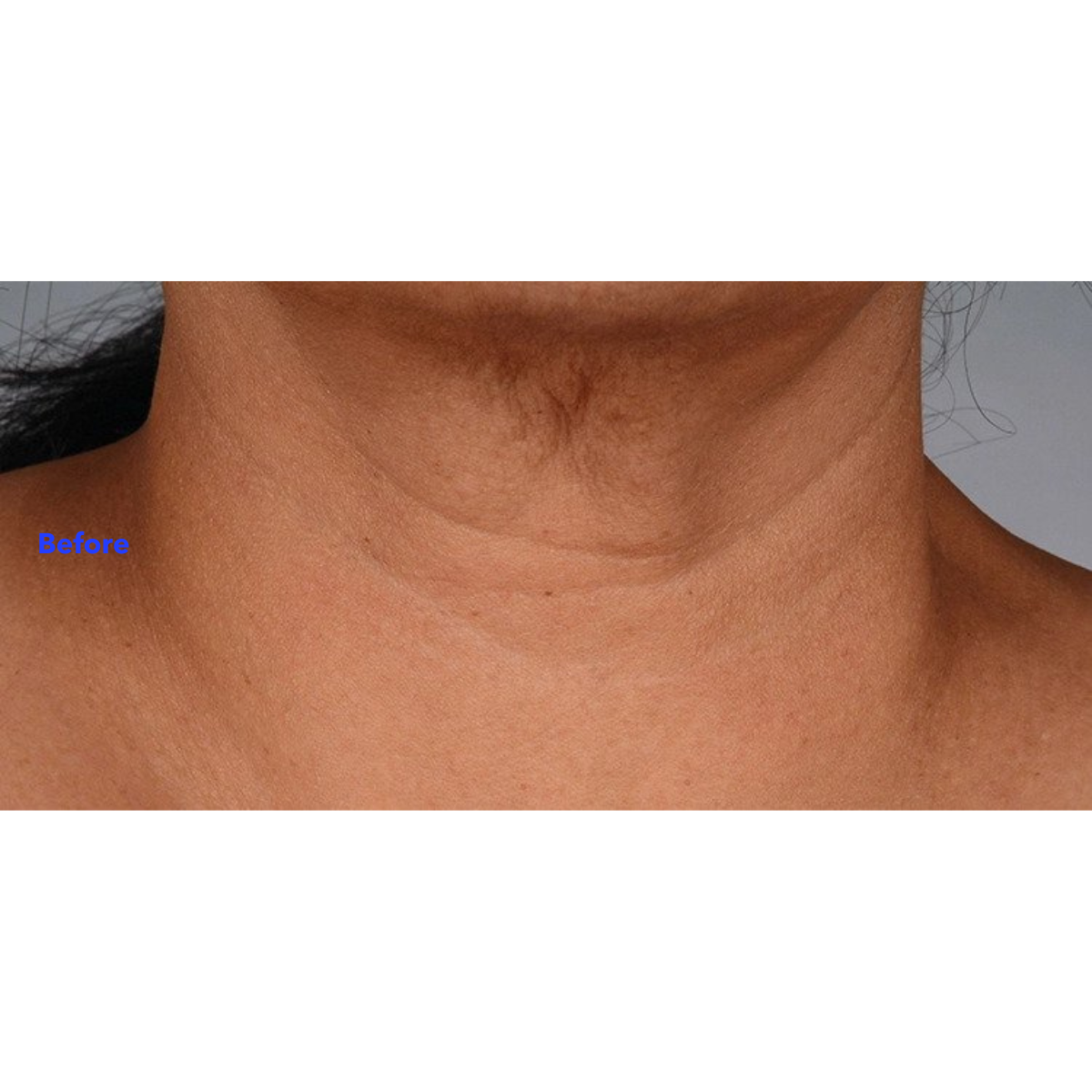 Neck Perfect Complex 50g | Brains Street