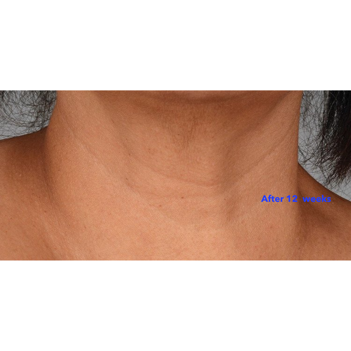 Neck Perfect Complex 50g | Brains Street