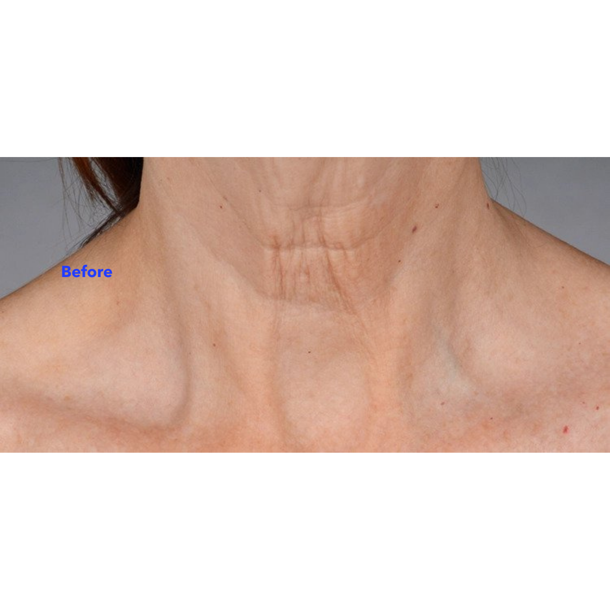 Neck Perfect Complex 50g | Brains Street