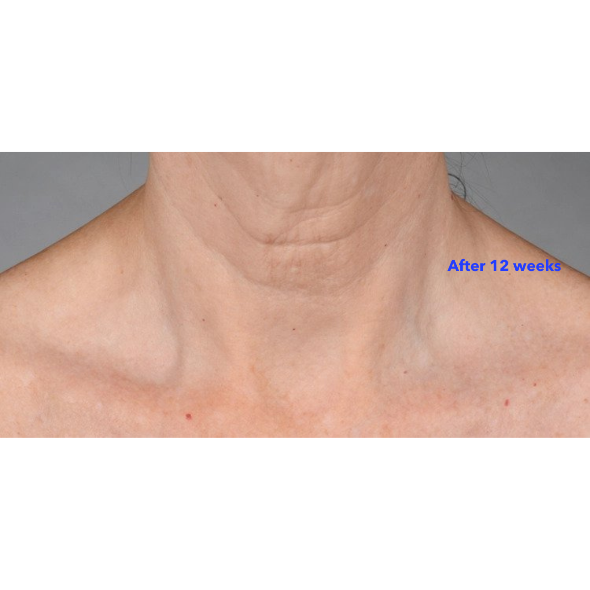 Neck Perfect Complex 50g | Brains Street
