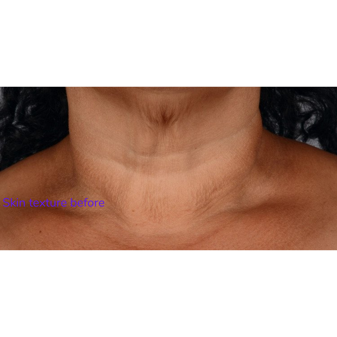 Neck Perfect Complex 50g | Brains Street