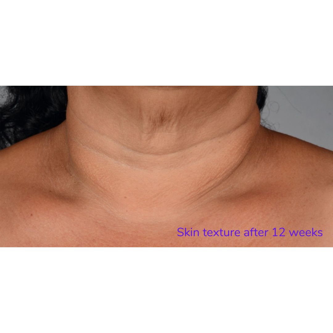 Neck Perfect Complex 50g | Brains Street