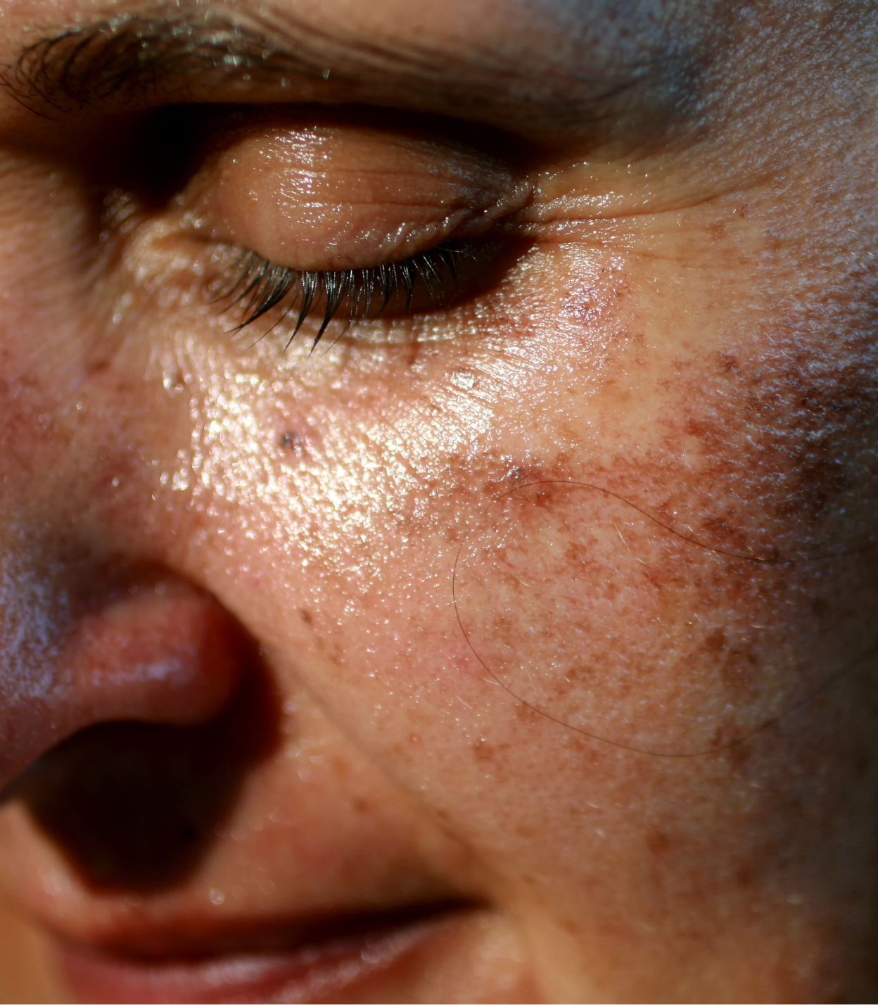 Fade skin pigmentation | Brains Street