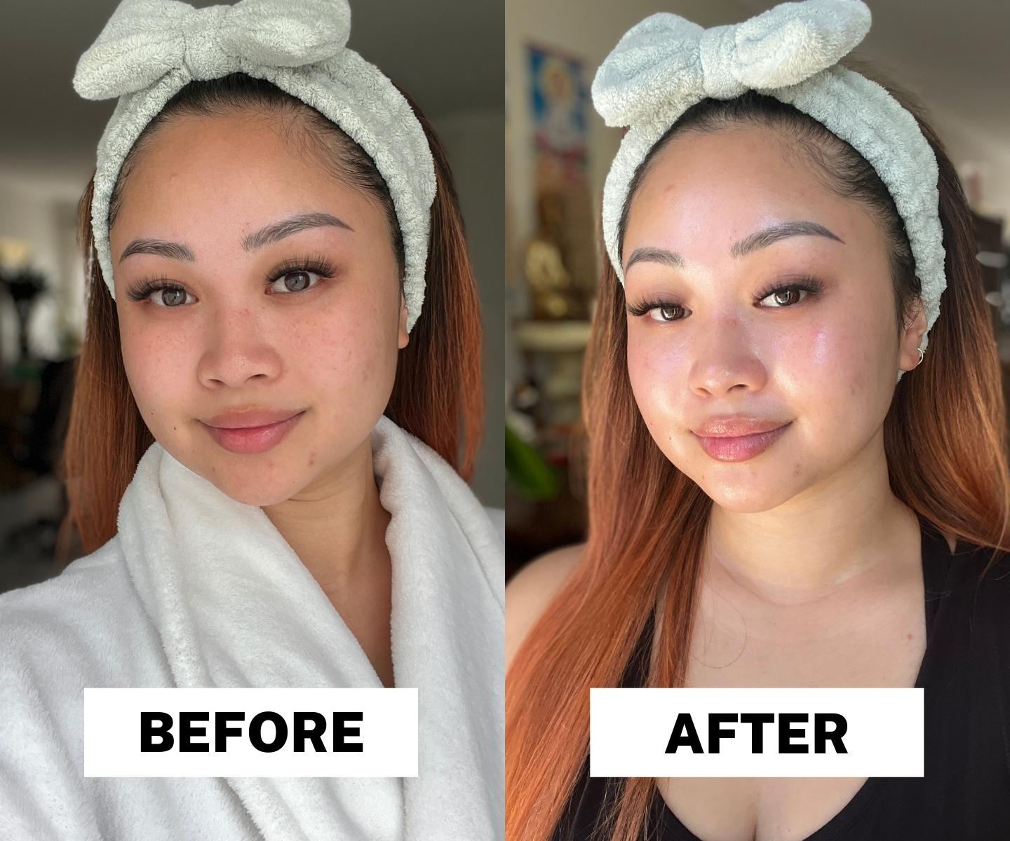 Replenishing Multi-Acid Peel 100ml