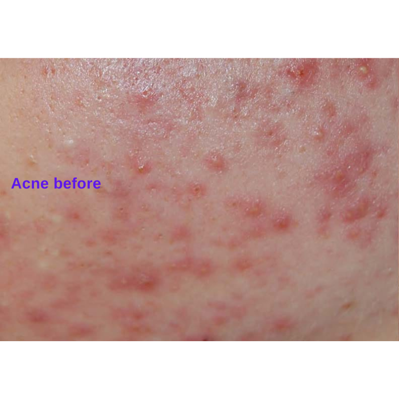 Active Serum