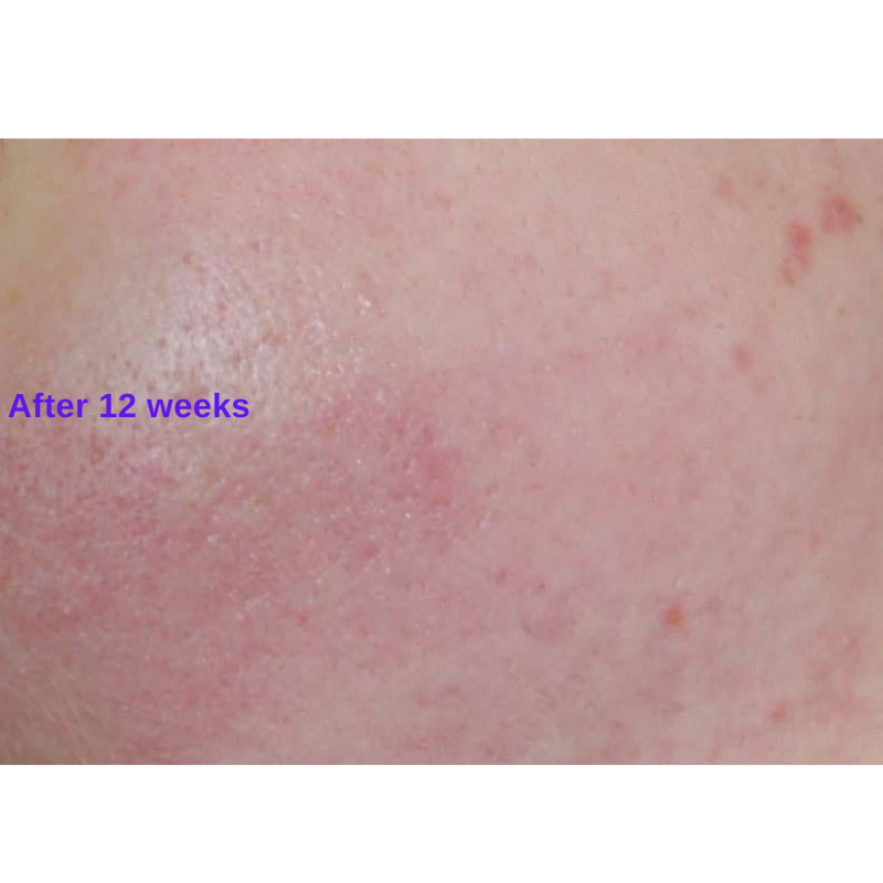 Active Serum