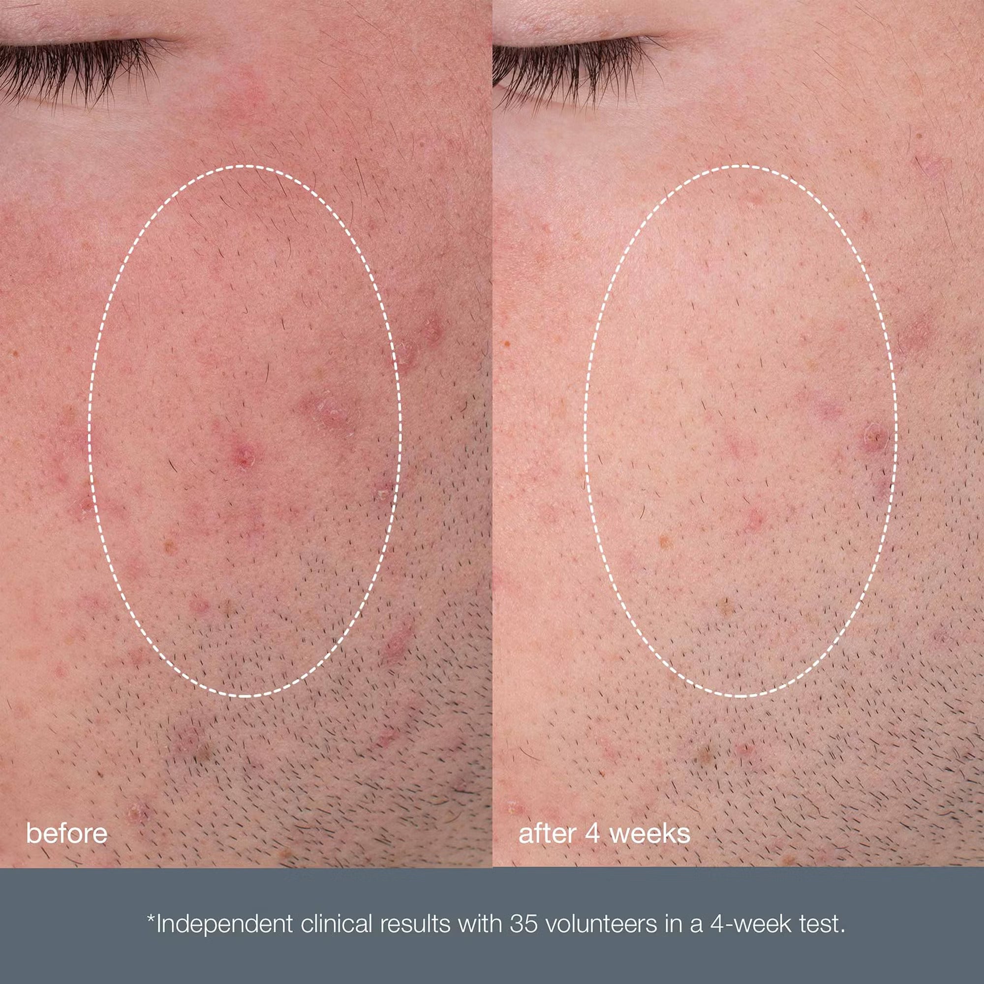 Daily Microfoliant 74g