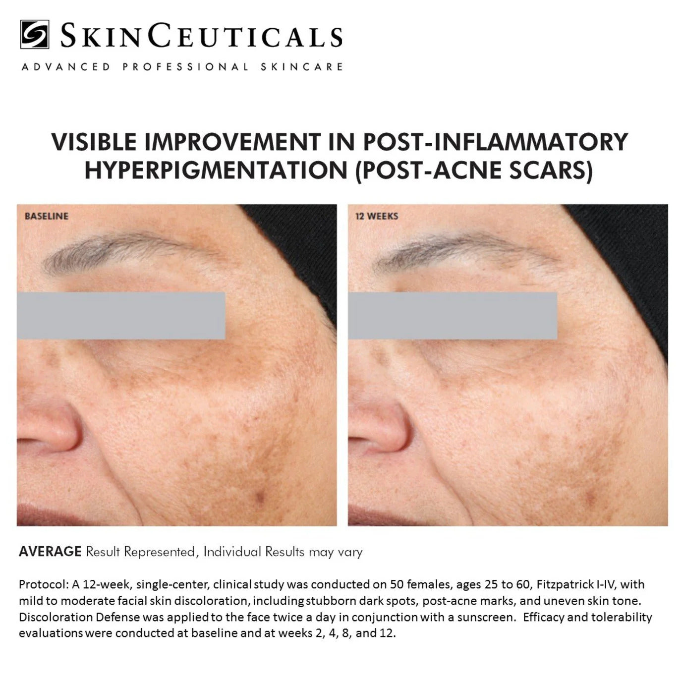 Discoloration_Defense_Before_and_after 