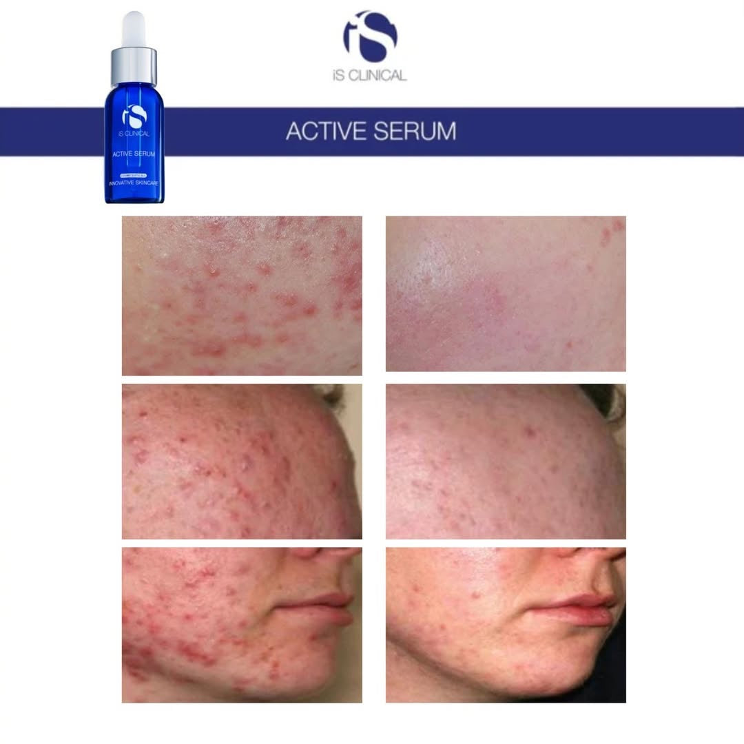 Active Serum