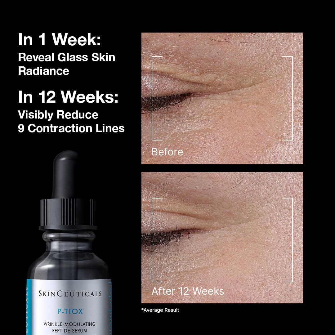 P-TIOX Peptide Serum 30ml - Firming Peptide Serum for Visible Wrinkle Reduction