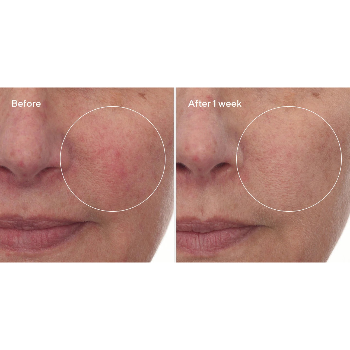 Cellular Hydration Barrier Repair Serum 30ml