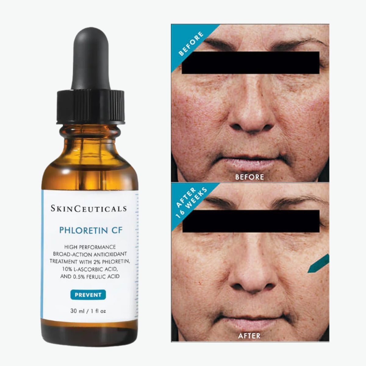 Brightening Duo Kit - Save $93