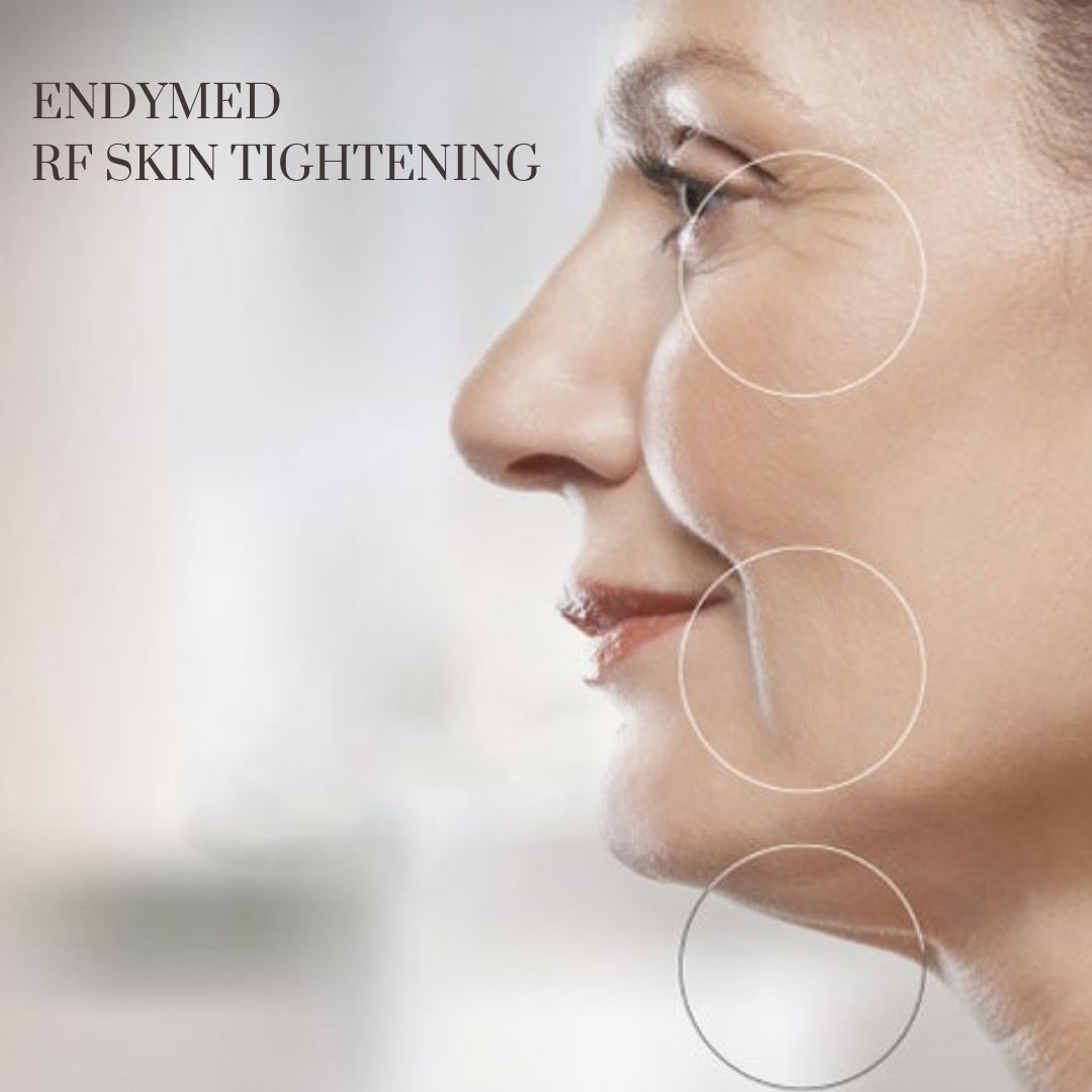 Radio Frequency Skin Tightening Eye | Brains Street