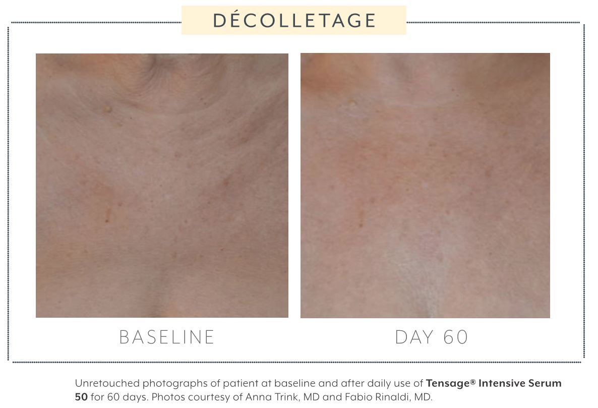 Tensage Intensive Serum 50 – 10 x 1.5ml tubes | Brains Street