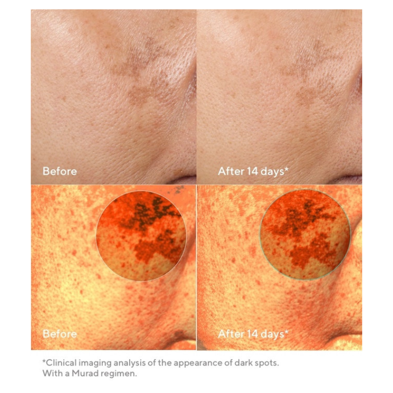 Rapid Dark Spot Correcting Serum 30ml