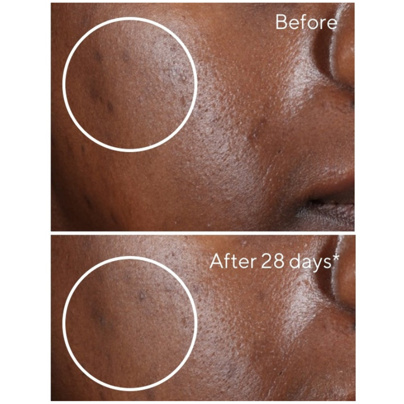 Rapid Dark Spot Correcting Serum 30ml
