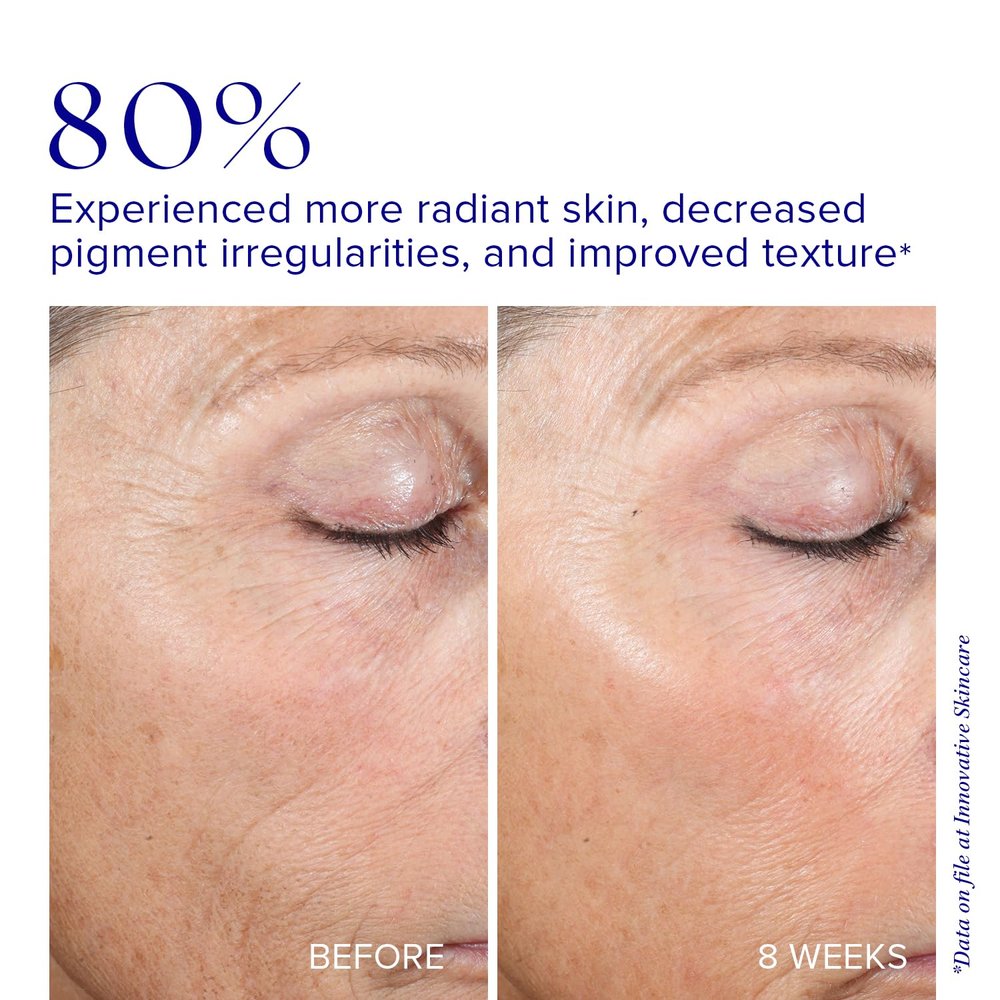 Active Peel System - Provides Controlled Botanical Exfoliation