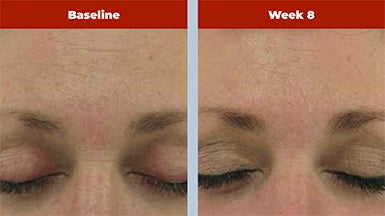 Retriderm Serum Mild - 0.5% Retinol For First-time Retinol Users.