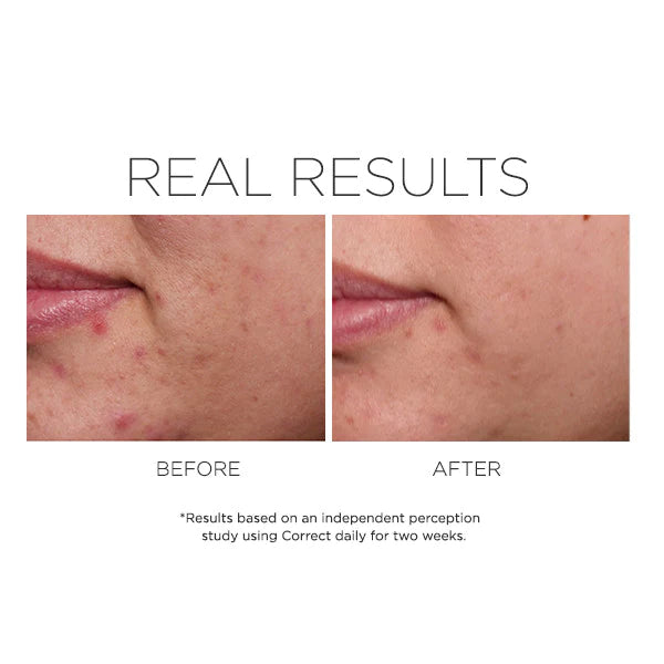 Rapid Relief Spot Treatment 15ml