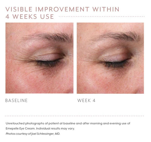 Emepelle Eye Cream 15ml - Helps Reduce Puffiness, Dark Circles & Signs of Ageing