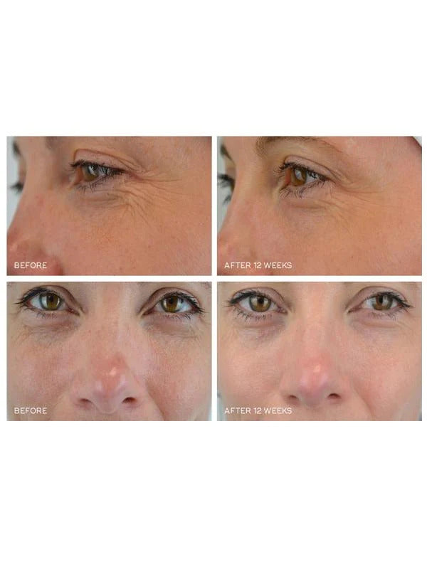 Crystal Retinal 20 30ml | Brains Street