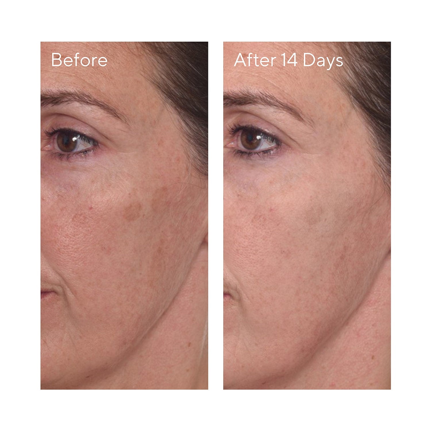 Rapid Dark Spot Correcting Serum 30ml