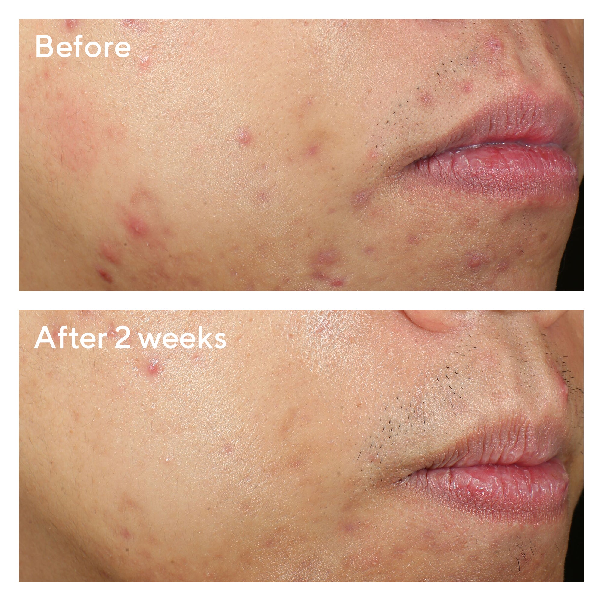 Rapid Relief Spot Treatment 15ml