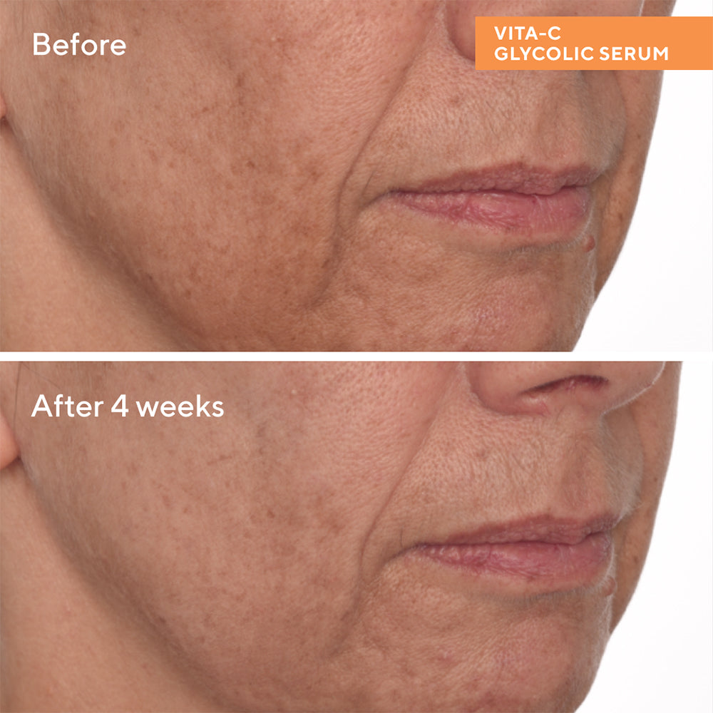 Vita-C Glycolic Brightening Serum 30ml