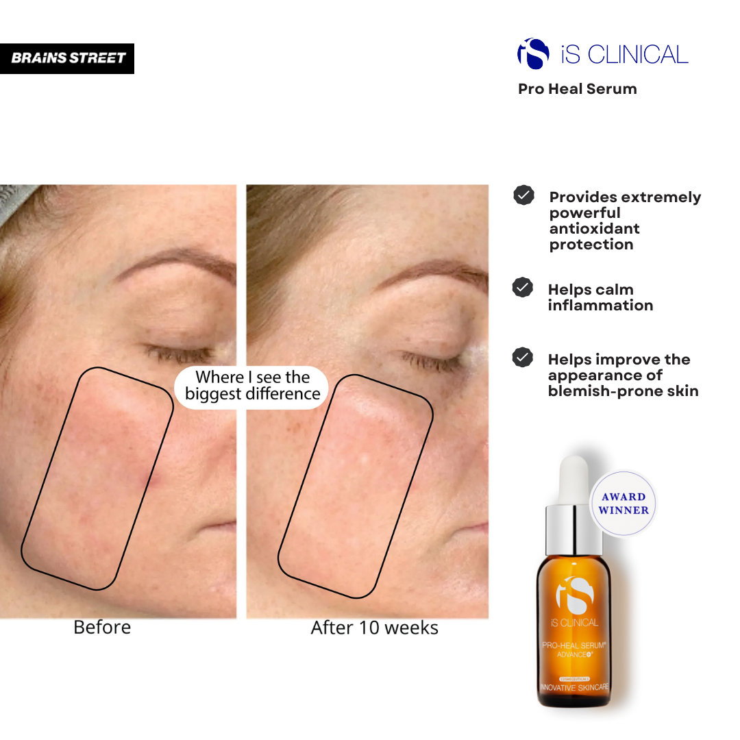 Pro-Heal Serum Advance+ | Brains Street