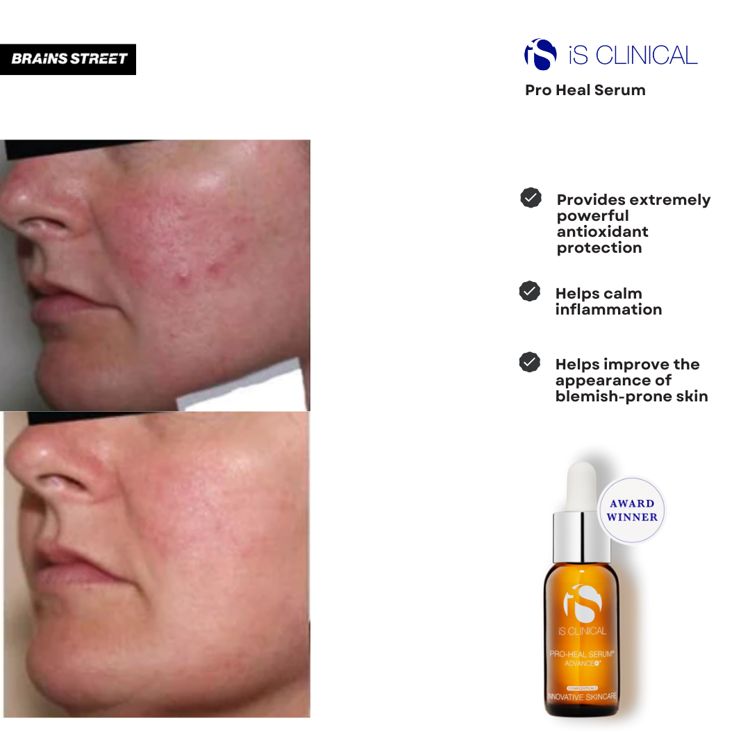 Pro-Heal Serum Advance+ | Brains Street
