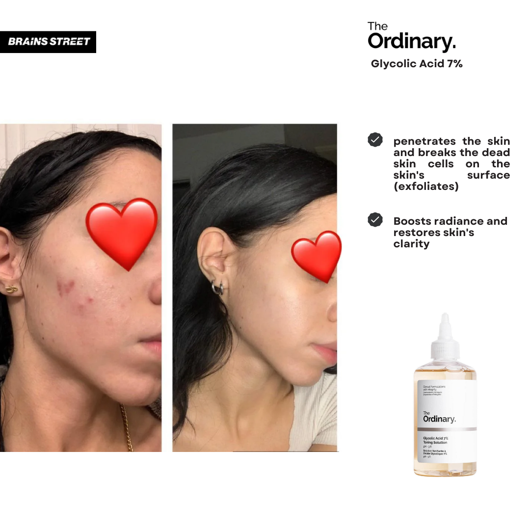 How To Use The Ordinary Glycolic Acid 7% Toning Solution 