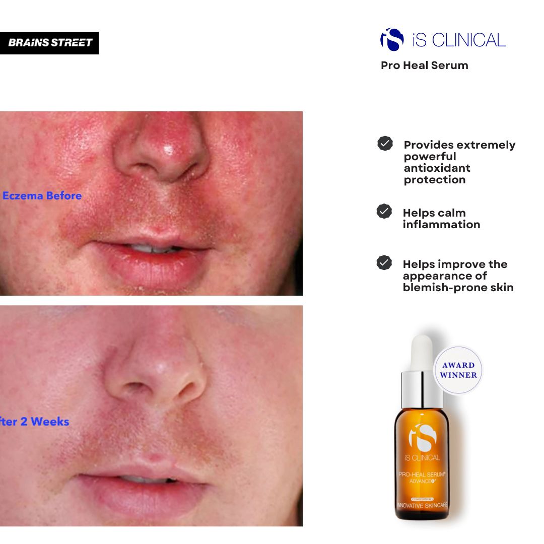 Pro-Heal Serum Advance+ | Brains Street