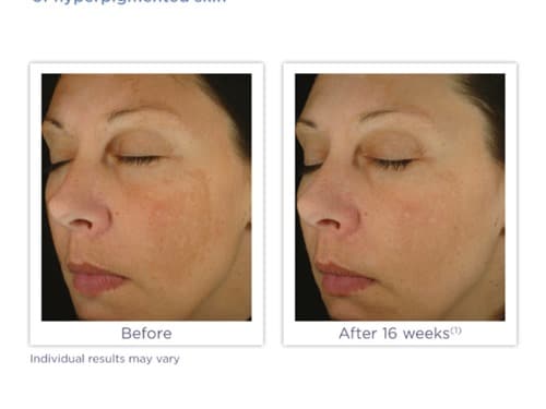 Brightening Complex 30g | Brains Street