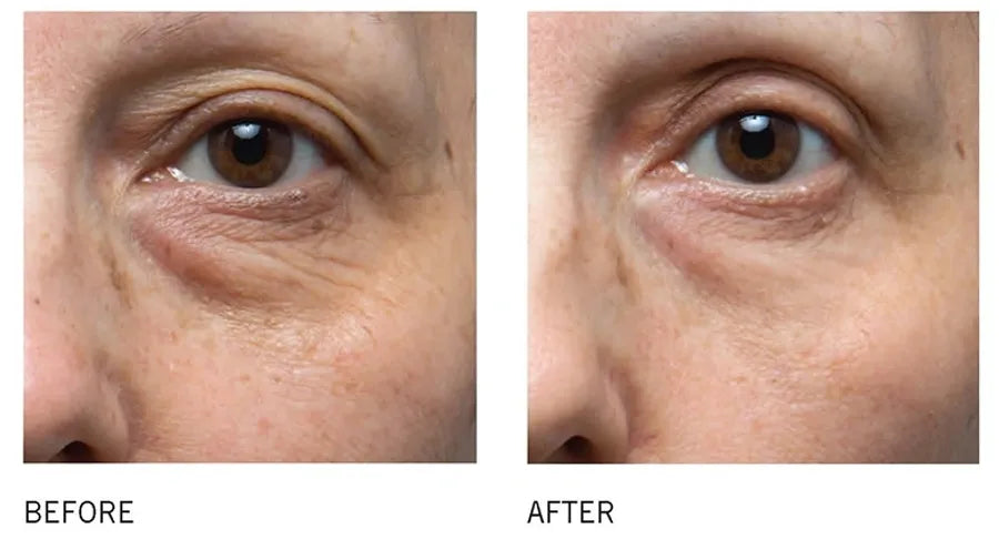 C Eye Serum Advance+ 15ml | Brains Street